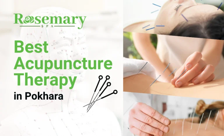 Best Acupuncture therapy in Pokhara